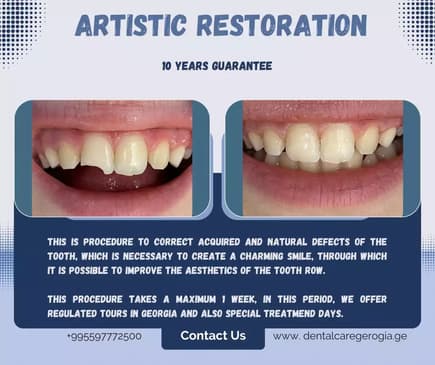 Slider image (2) Universe Dental - Best Dental Clinic in Tbilisi, Georgia